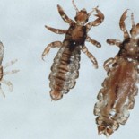 lice