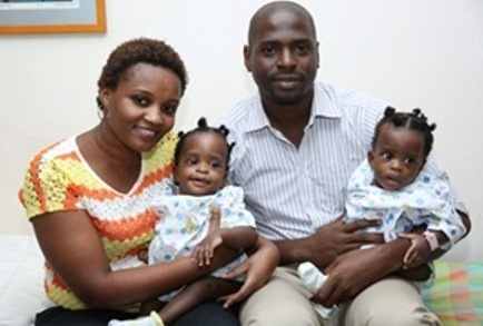 Female Twins from Tanzania Separated at Apollo Hospitals