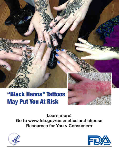 Black Henna Tattoos May Put You at Risk