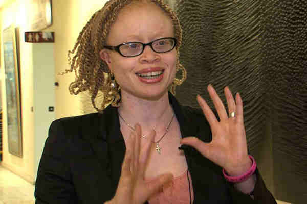 Independent Expert on Albinism Ikponwosa Ero. Photo: OHCHR / Christine Wambaa
