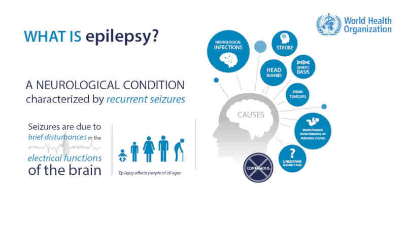 Epilepsy